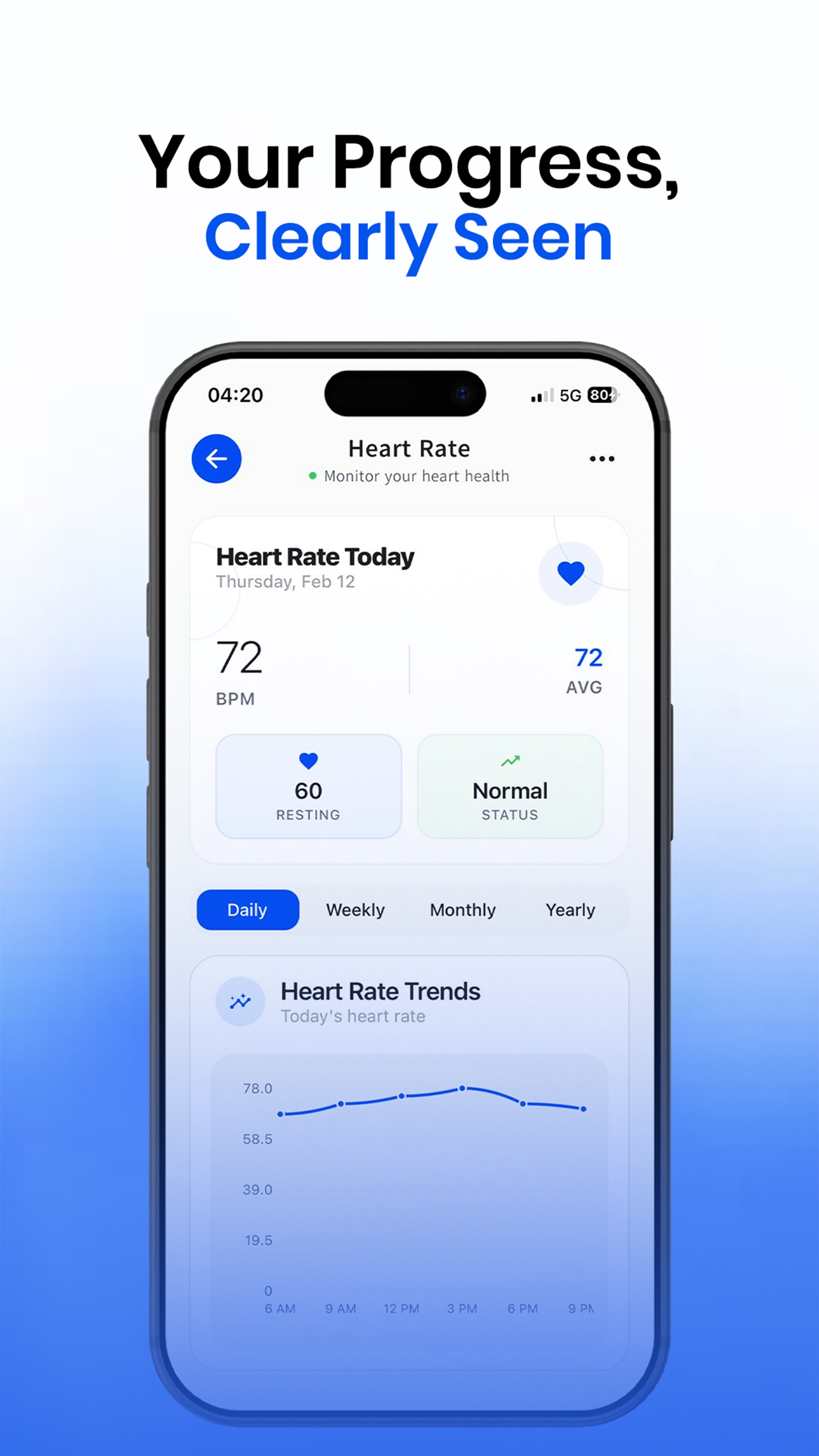 Heart Rate Monitoring